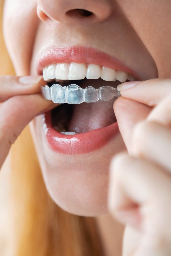 Clear aligner treatment