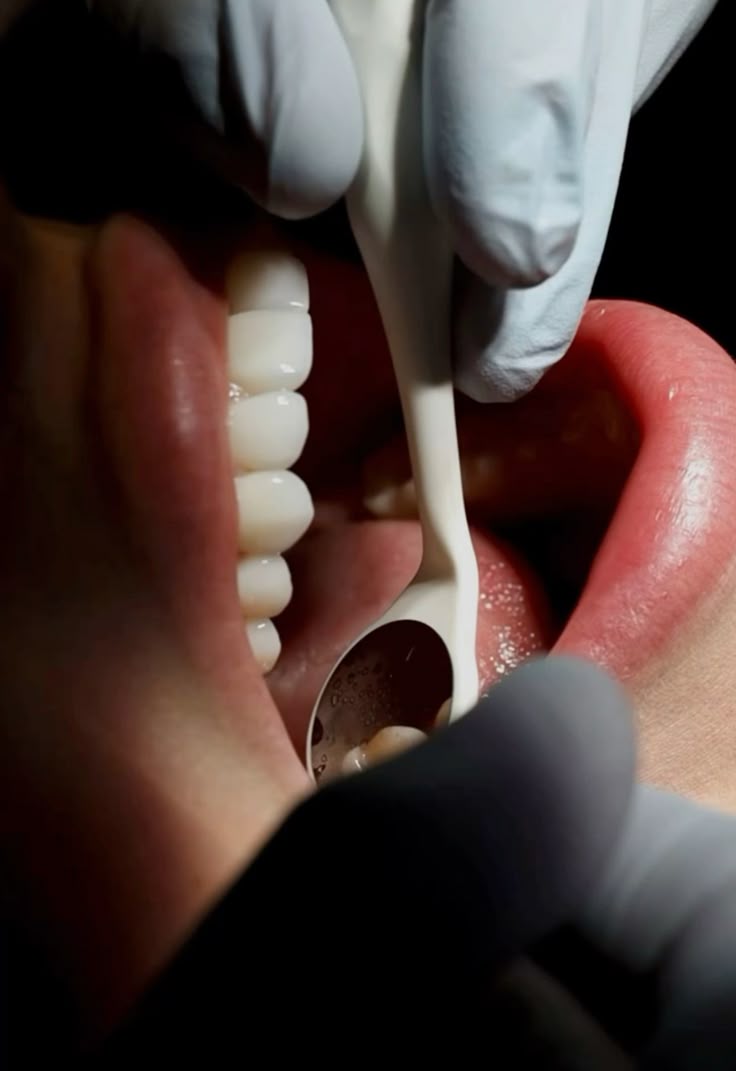 Root canal treatment